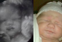 fra 3d scanning i 34. uge til få timer gammel baby