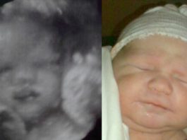 fra 3d scanning i 34. uge til få timer gammel baby