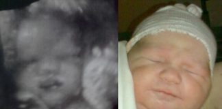 fra 3d scanning i 34. uge til få timer gammel baby