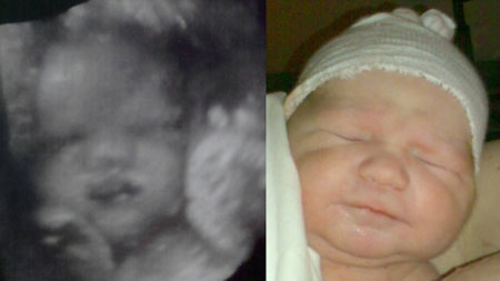 3d_forefter_1s fra 3d scanning i 34. uge til få timer gammel baby