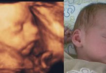 fra 3d scanning i 26. uge til baby