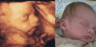 fra 3d scanning i 26. uge til baby