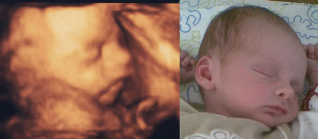 fra 3d scanning i 26. uge til baby