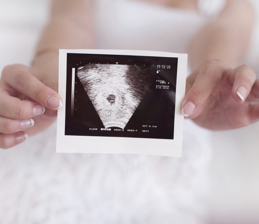 Bør man kunne se hjertet slå til en scanning i uge 6? Bør man kunne se hjertet slå til en scanning i uge 6