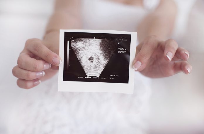 boer-man-kunne-se-hjertet-slaa-til-en-scanning-i-uge-6_61001338 Bør man kunne se hjertet slå til en scanning i uge 6