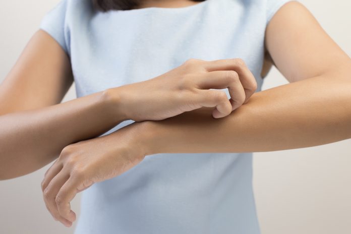 er-det-farligt-naar-det-kloer-over-hele-kroppen-og-man-er-gravid_62915980 Er det farligt når det klør over hele kroppen og man er gravid?