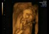 uge 18+6