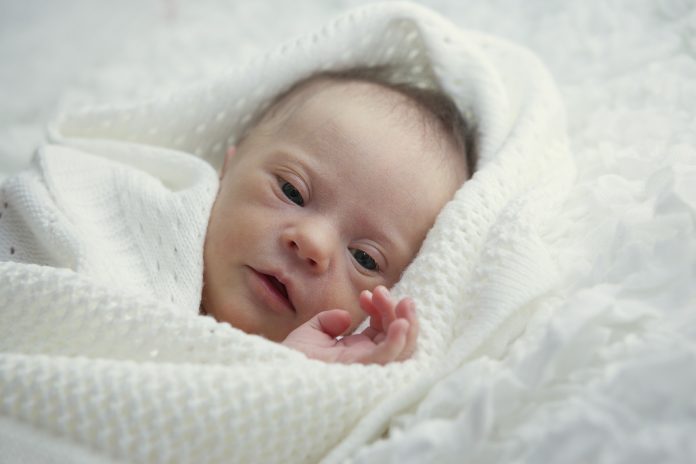 newborn with Down syndrome is quiet and looks Baby efter fødslen