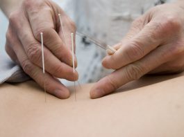 Kan akupunktur hjælpe os med at blive gravide? Kan akupunktur hjælpe os med at blive gravide?