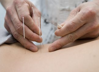 Kan akupunktur hjælpe os med at blive gravide? Kan akupunktur hjælpe os med at blive gravide?