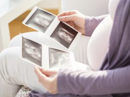 Jeg er nervøs efter min misdannelsesscanning. Kan mit barn være handicappet?