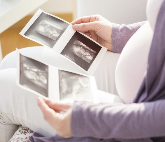 Kan mit barn være handicappet på trods af fin misdannelsesscanning? Jeg er nervøs efter min misdannelsesscanning. Kan mit barn være handicappet?