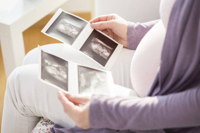 Jeg er nervøs efter min misdannelsesscanning. Kan mit barn være handicappet? Jeg er nervøs efter min misdannelsesscanning. Kan mit barn være handicappet?